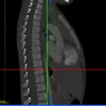 Articolo Stampa 3D in clinica 2