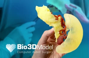 Bio3DModel_Intervento_milza