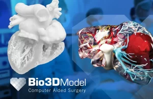 Bio3DNews Blog 1 Bio3DNews_Custom_o_standard_2