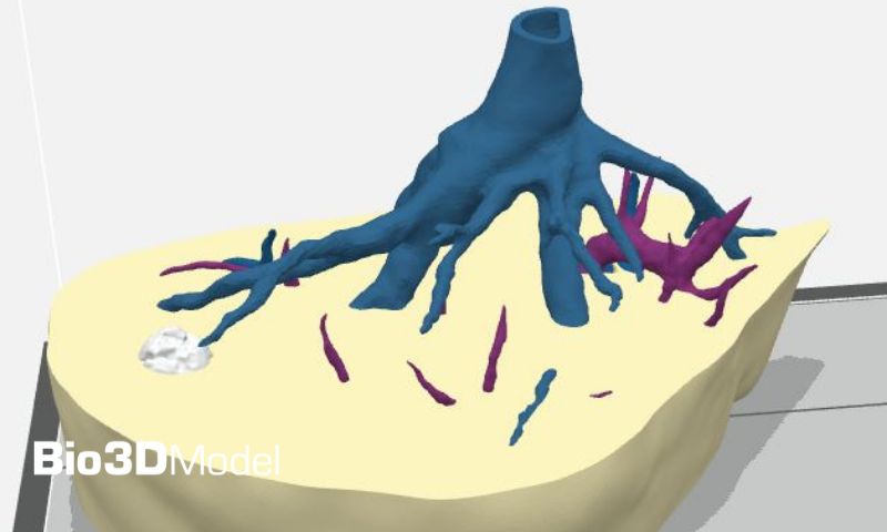 Il fegato si tocca e si cura 2 Fegato bio3dnews