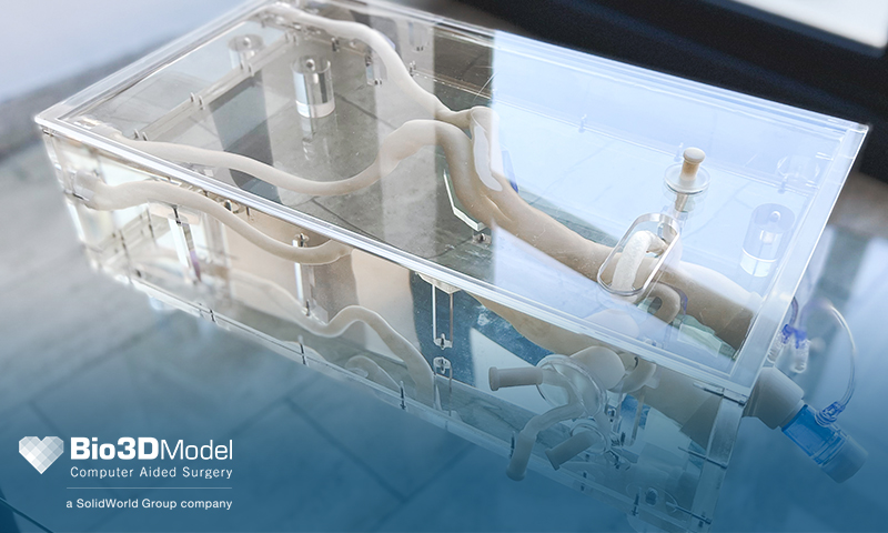 Bio3DModel e SolidWorld GROUP creano un nuovo simulatore aortico in 3D per accesso endovascolare 1 Simulatore aortico