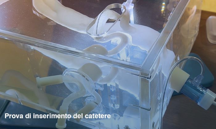 Bio3DModel e SolidWorld GROUP creano un nuovo simulatore aortico in 3D per accesso endovascolare 3 Prova di inserimento del catetere nel simulatore aortico