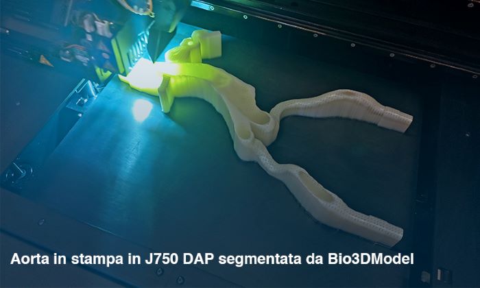 Bio3DModel e SolidWorld GROUP creano un nuovo simulatore aortico in 3D per accesso endovascolare 2 Simulatore aortico segmentato